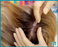 Газожидкостный пилинг волосистой части головы за 600 руб. в Орле