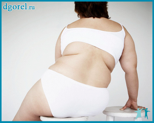 Как лечить ожирение у женщин?
