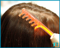 Дарсонвализация волосистой части головы за 150 руб. в Орле